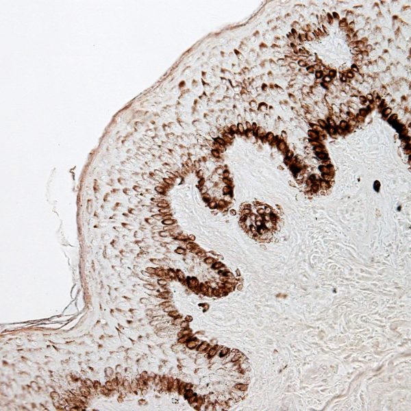 Thin skin epidermis stained with the Fontana silver method showing a large presence of melanin pigment in the basal and spinous layers. The pigmented cells are both melanocytes and keratinocytes.
